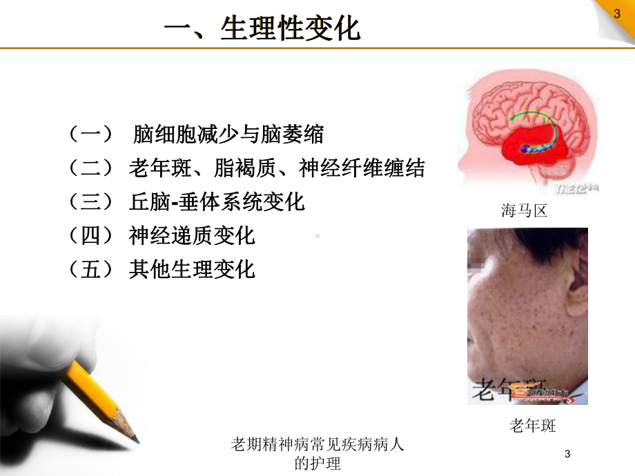 老期精神病常见疾病病人的护理培训课件.ppt_第3页