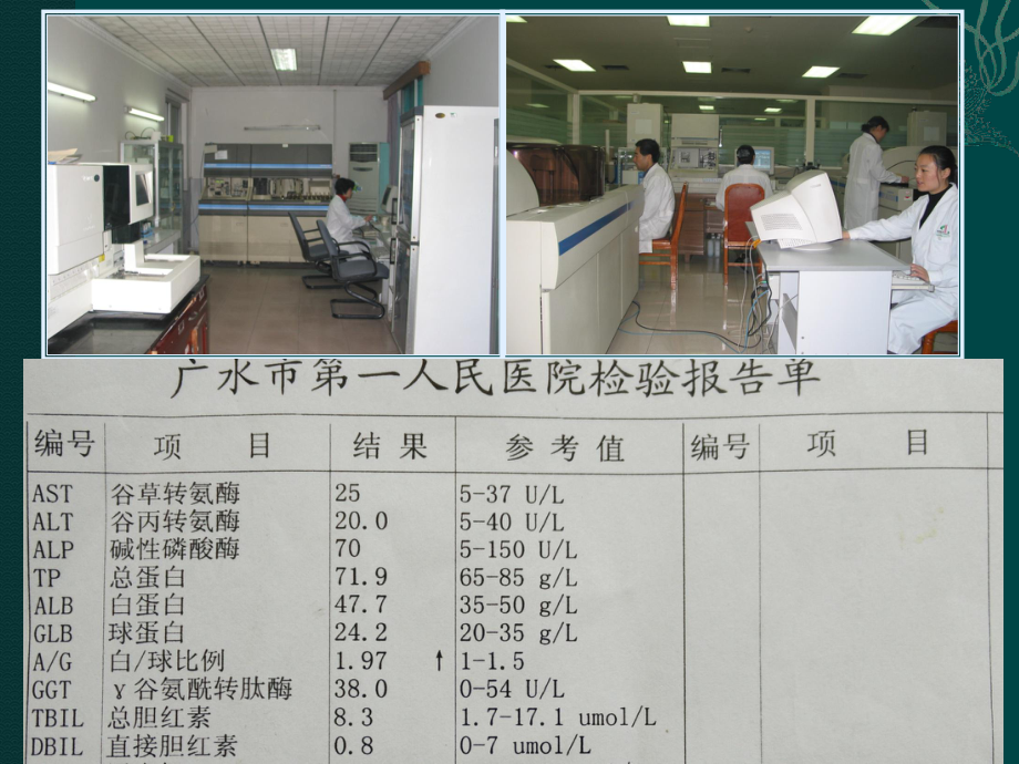 肝功能损害的诊断思路-及护肝药物的临床应用教学课件.ppt_第2页