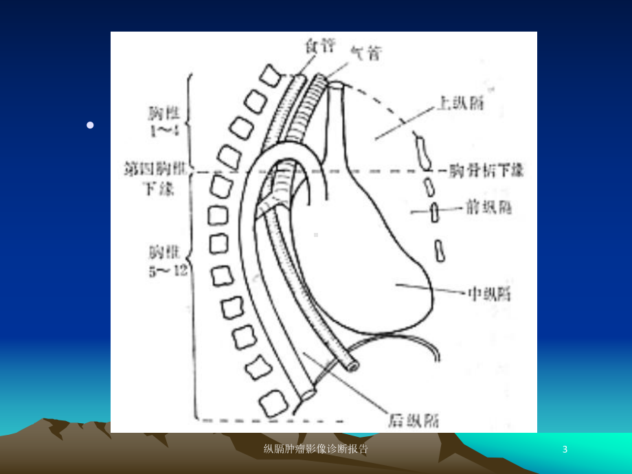 纵膈肿瘤影像诊断报告培训课件.ppt_第3页