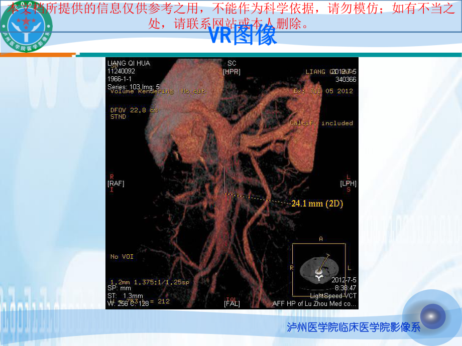 缺血性肠病的影像诊疗培训课件.ppt_第2页