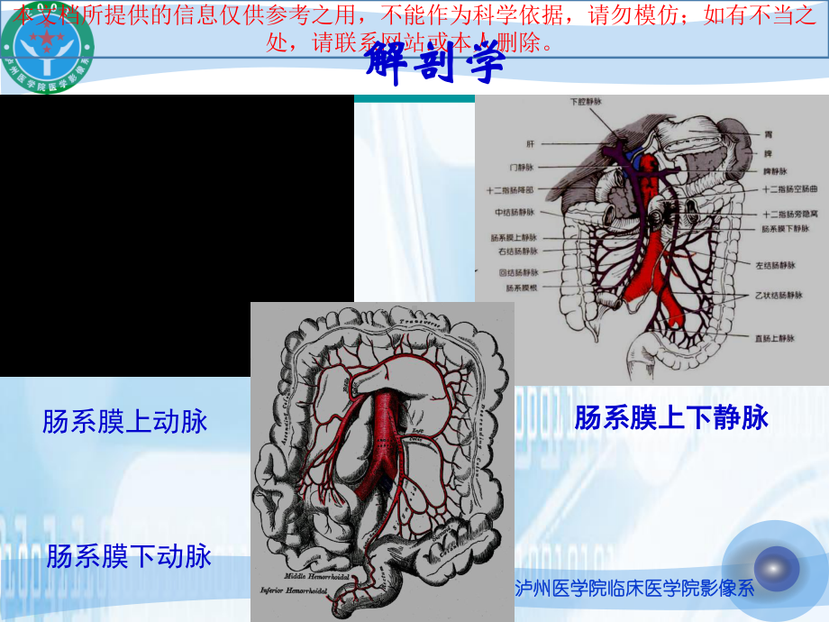 缺血性肠病的影像诊疗培训课件.ppt_第3页