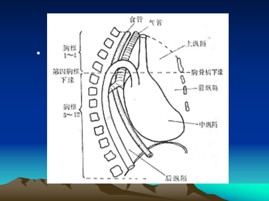 纵隔肿瘤影像诊课件.ppt_第3页