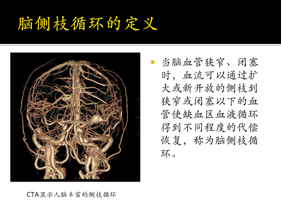 精彩的脑侧枝循环与卒中课件教材.ppt_第2页