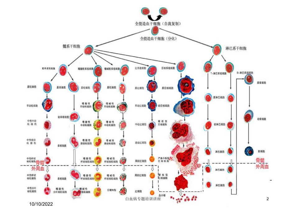 白血病专题培训讲座培训课件.ppt_第2页