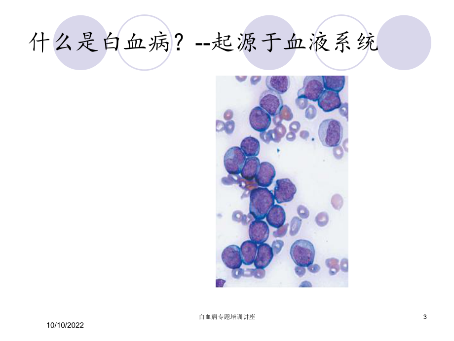 白血病专题培训讲座培训课件.ppt_第3页