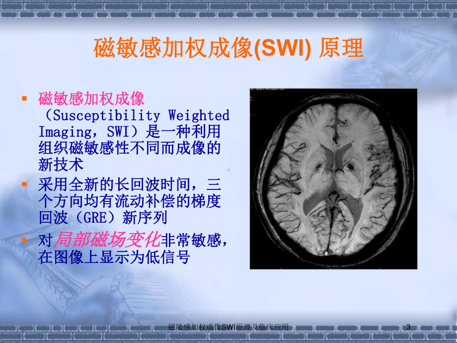 磁敏感加权成像SWI原理及临床应用培训课件.ppt_第3页