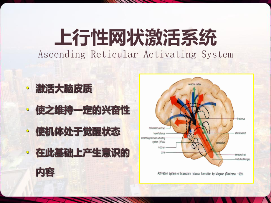 神经系统疾病常见症状-课件.pptx_第3页