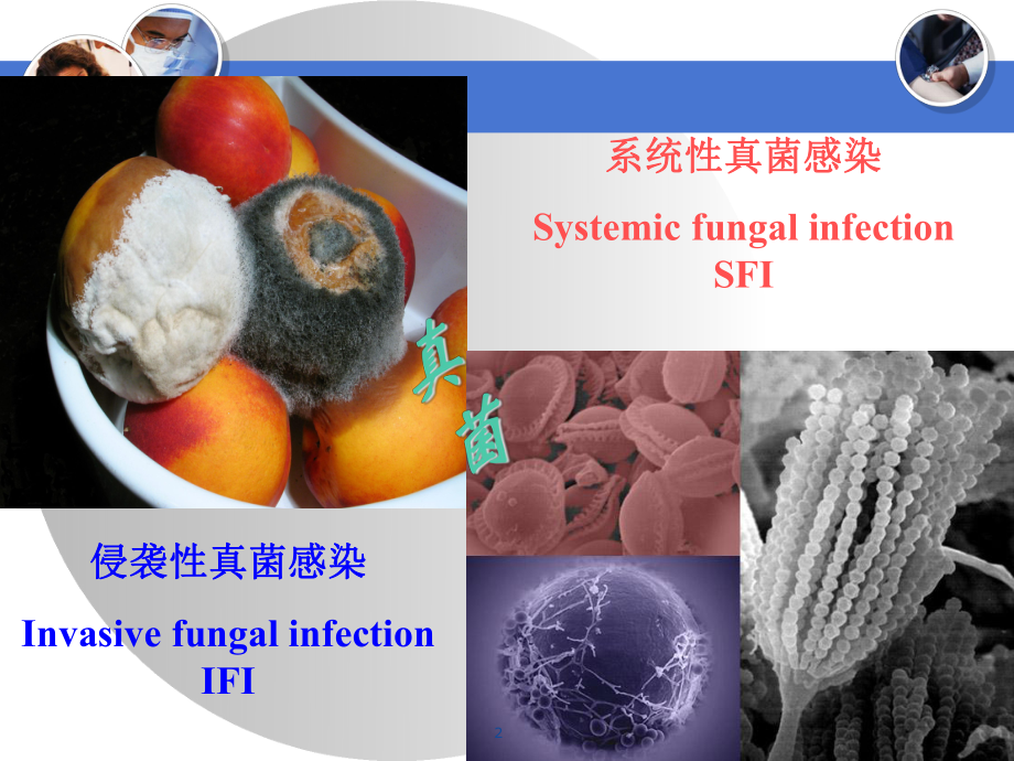 真菌感染的基础和临床医学课件.ppt_第2页