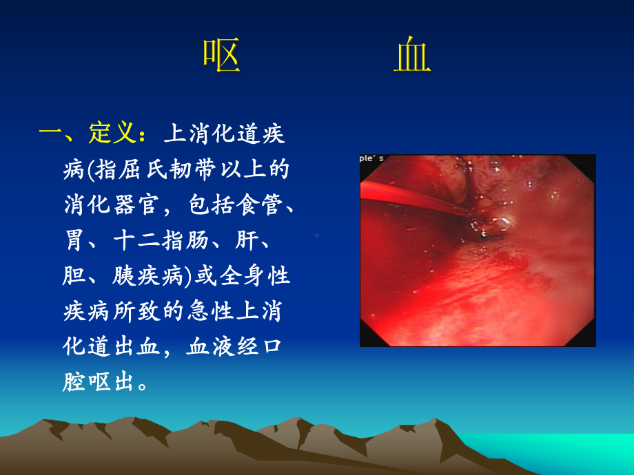 六节呕血与便血-课件.ppt_第3页