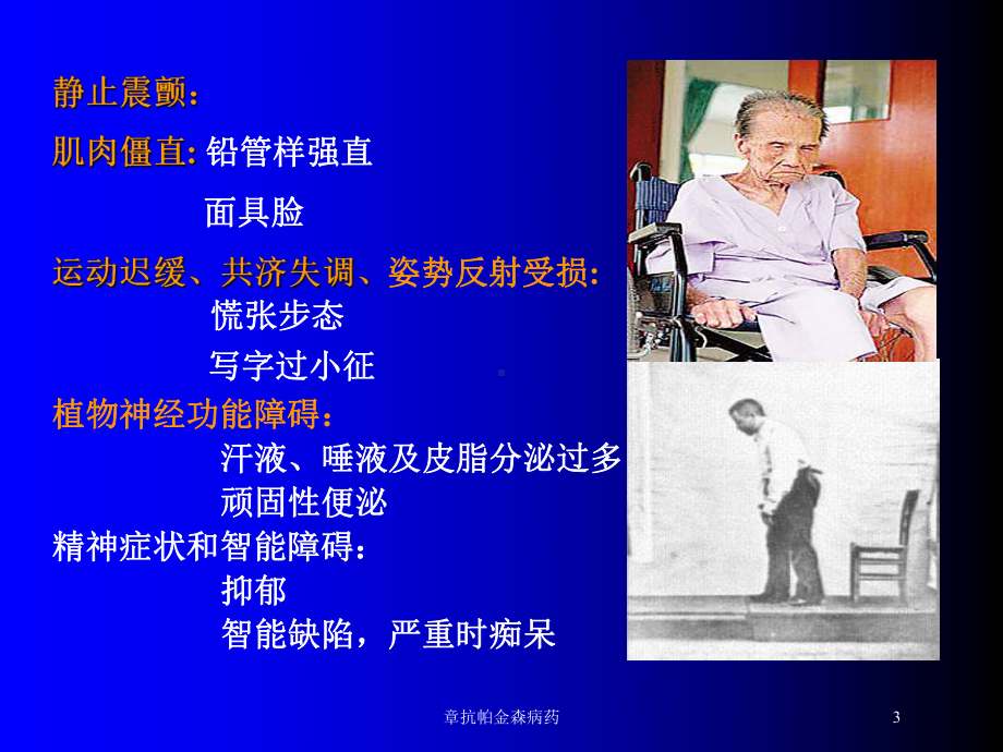 章抗帕金森病药培训课件.ppt_第3页