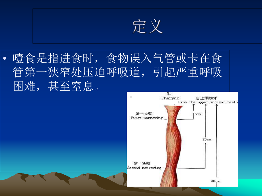 精神病人噎食护理课件.ppt_第2页