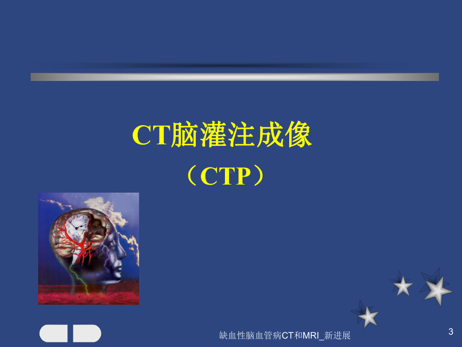 缺血性脑血管病CT和MRI-新进展课件.ppt_第3页