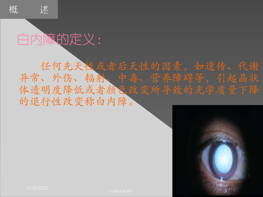 白内障全科课件培训课件.ppt_第3页