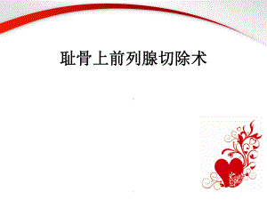 耻骨上前列腺切除术课件.ppt