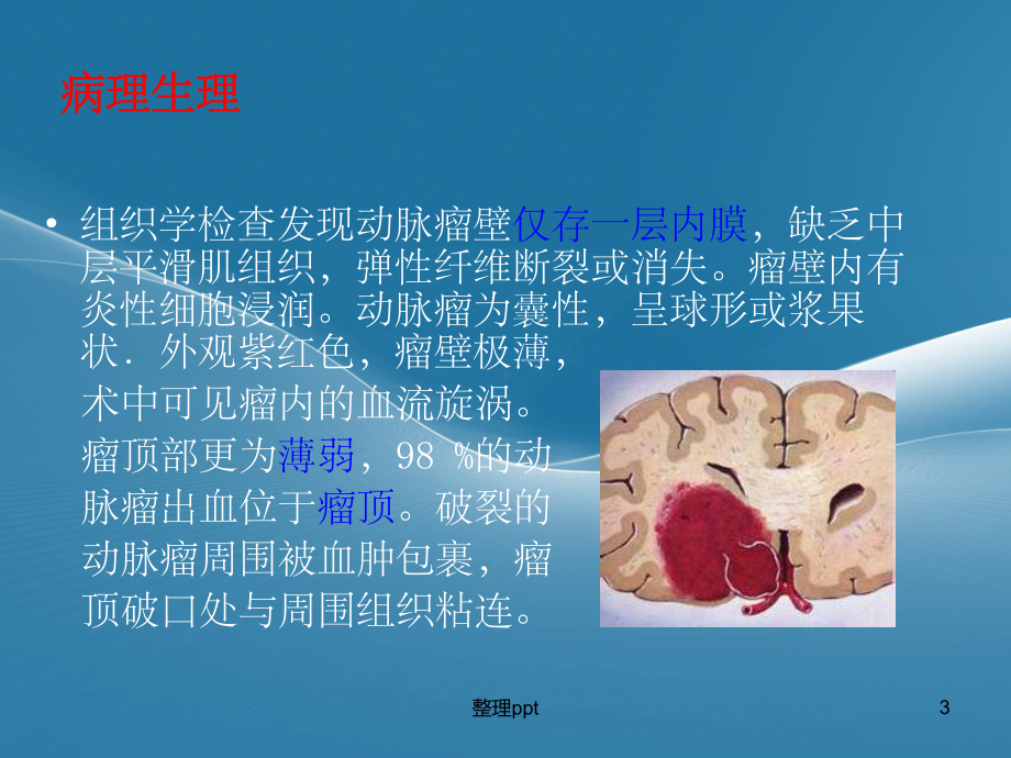 神经外科颅内动脉瘤课件.ppt_第3页