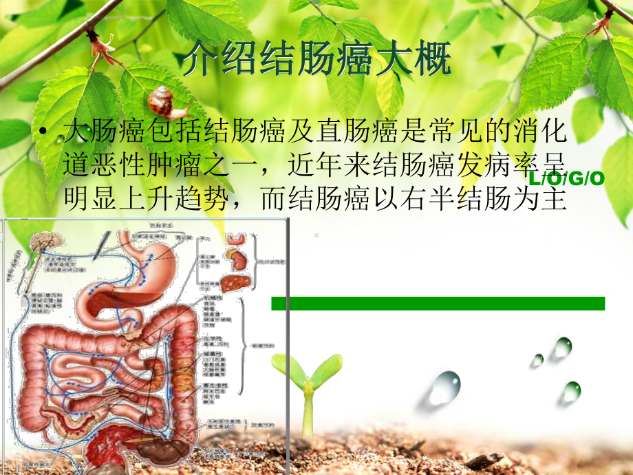 结肠癌教学查房课件完整版.pptx_第1页