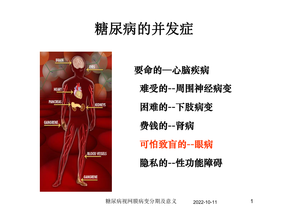 糖尿病视网膜病变分期及意义培训课件.ppt_第1页