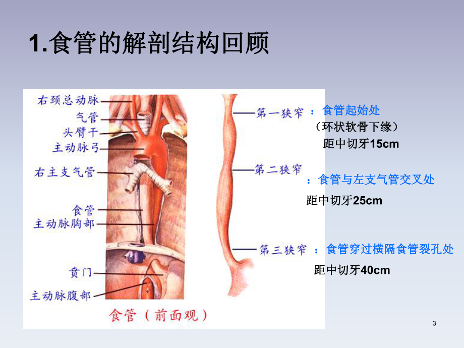 精选食管癌病人的护理课件.pptx_第3页