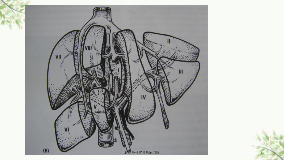 肝胆外科常见疾病CT阅课件.ppt_第3页