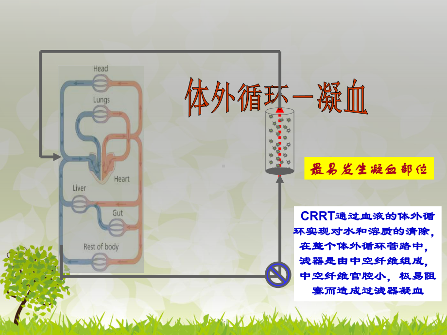 CRRT局部枸橼酸抗凝教学课件.ppt_第2页