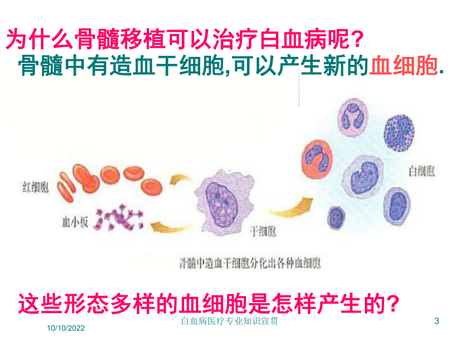 白血病医疗专业知识宣贯培训课件.ppt_第3页