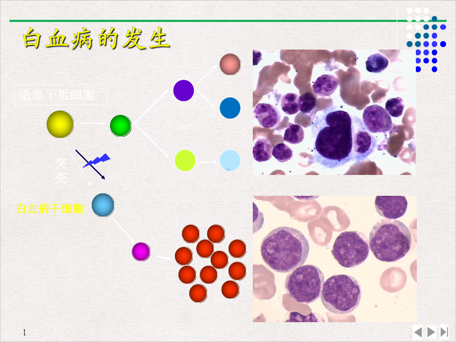 白血病定稿课件.pptx_第3页