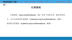 红斑狼疮详细介绍培训课件.ppt