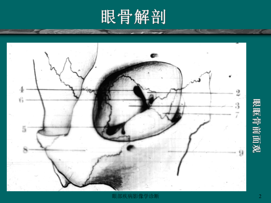 眼部疾病影像学诊断课件.ppt_第2页