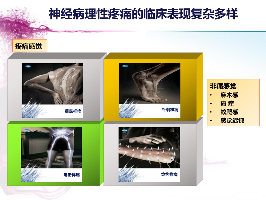 神经妥乐平治疗腰椎间盘突出症的临床观察新版课件.pptx_第2页