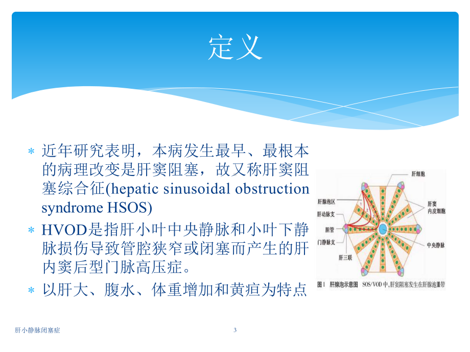 肝小静脉闭塞症培训课件.ppt_第3页