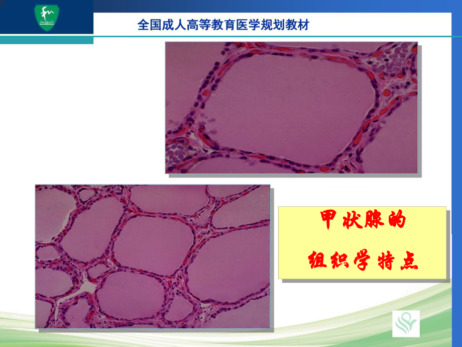 13章-内分泌系统常见疾病课件.pptx_第3页