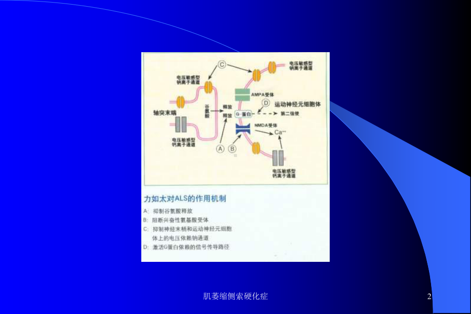 肌萎缩侧索硬化症课件.ppt_第2页