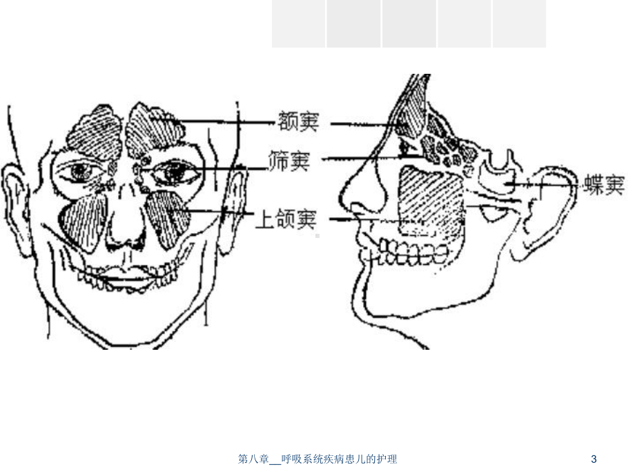 第八章--呼吸系统疾病患儿的护理课件.ppt_第3页