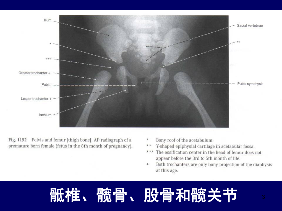 下肢的断层解剖人体断层解剖学(课堂)课件.ppt_第3页