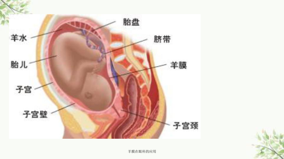 羊膜在眼科的应用课件.ppt_第3页