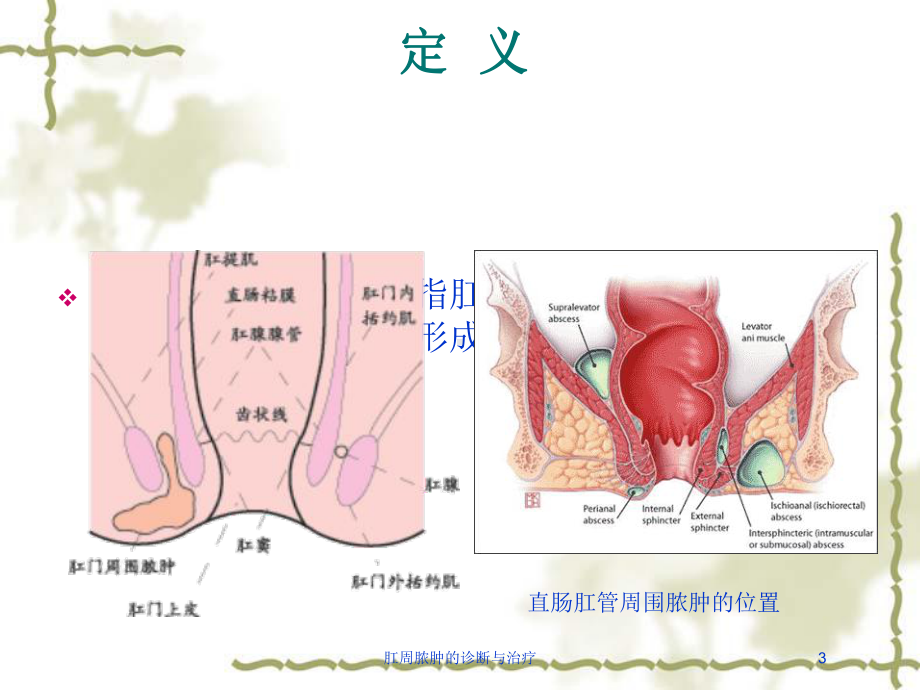 肛周脓肿的诊断与治疗培训课件.ppt_第3页