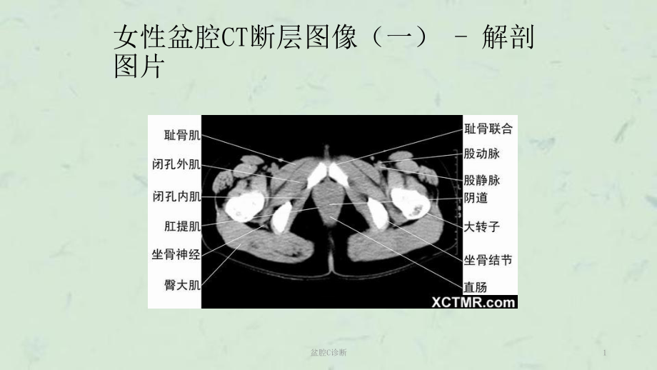 盆腔C诊断课件.ppt_第1页