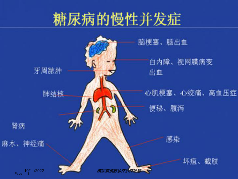 糖尿病预防诊疗治疗讲解培训课件.ppt_第3页