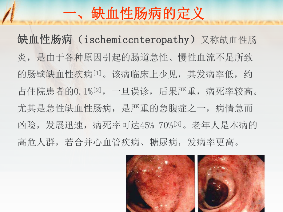 缺血性肠病治疗及护理课件.ppt_第3页