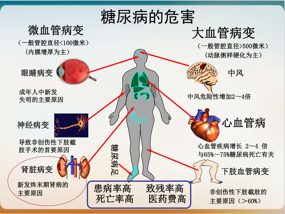 糖尿病肾病中医分期治疗1课件.ppt_第3页