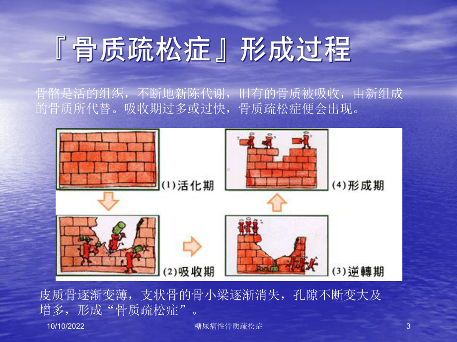 糖尿病性骨质疏松症培训课件.ppt_第3页