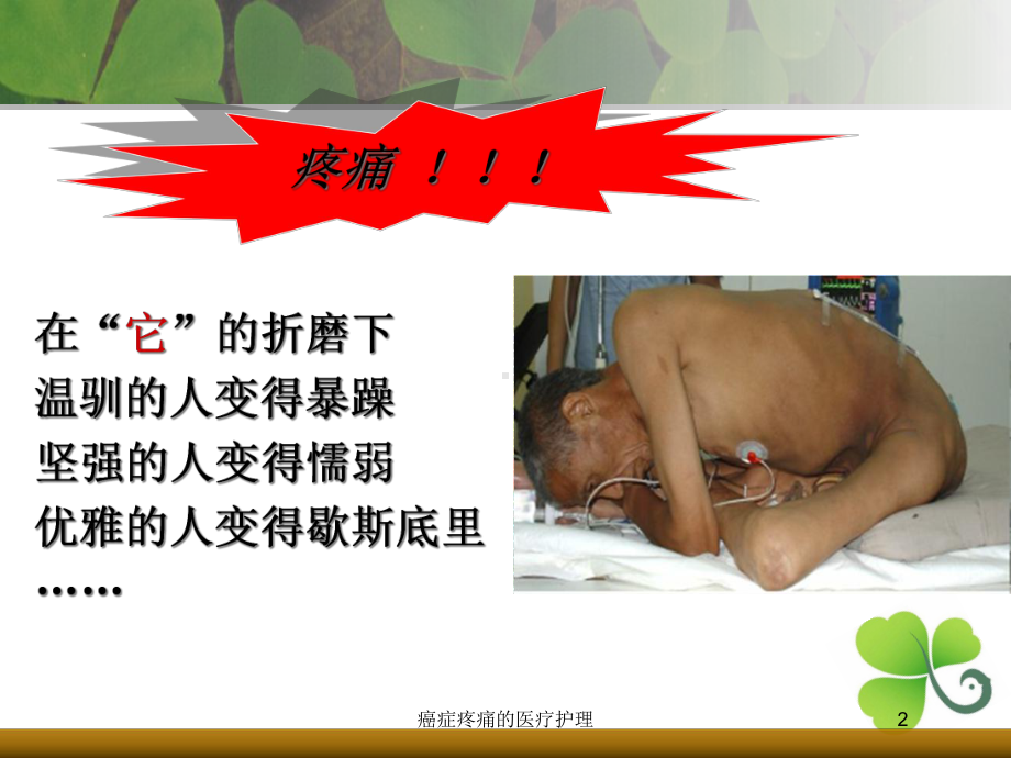 癌症疼痛的医疗护理培训课件.ppt_第2页