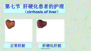 肝硬化患者的护理课件.ppt