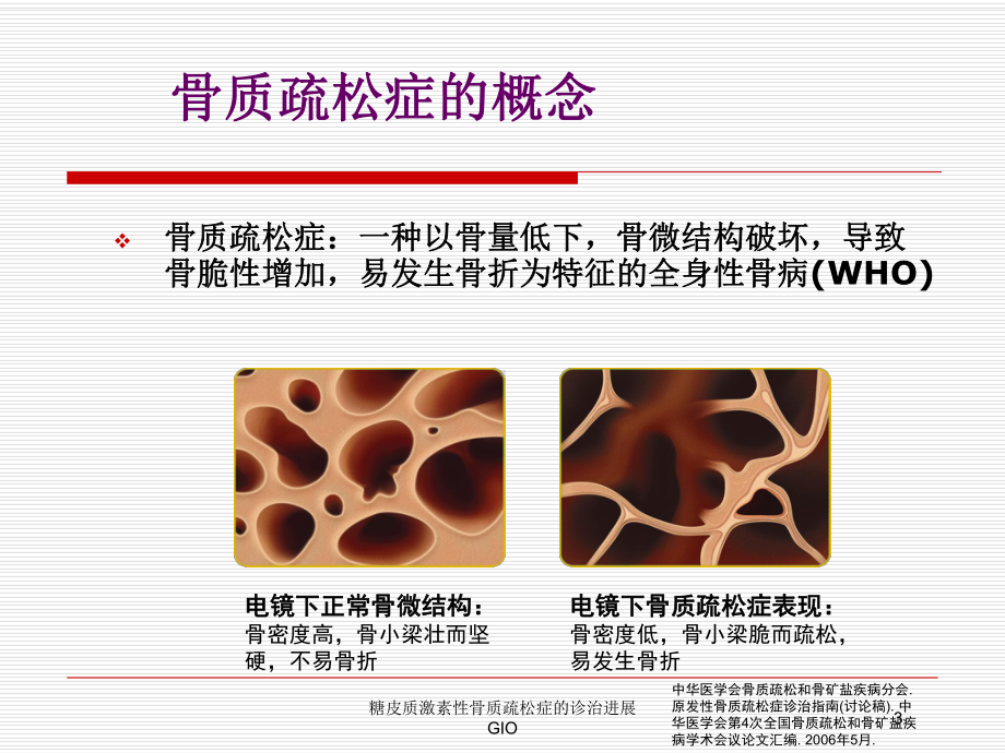 糖皮质激素性骨质疏松症的诊治进展GIO培训课件.ppt_第3页