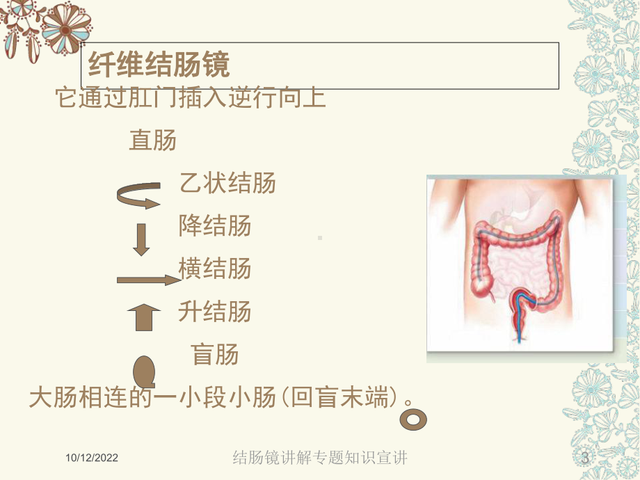 结肠镜讲解专题知识宣讲培训课件.ppt_第3页