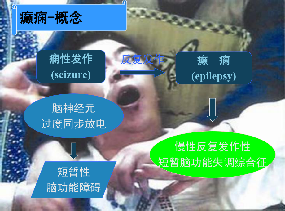 癫痫手术治疗术前评估课件.ppt_第3页