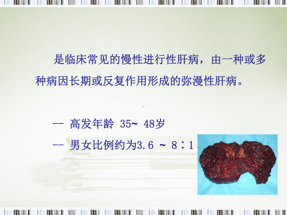 肝硬化护理课件.ppt_第2页