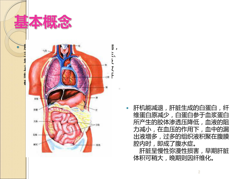 肝硬化护理查房稿课件.ppt_第2页