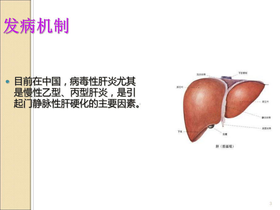 肝硬化护理查房稿课件.ppt_第3页