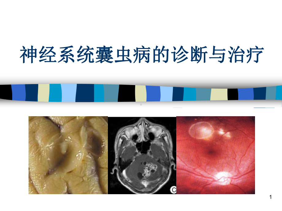 神经系统囊虫病的诊断和治疗参考课件.ppt_第1页